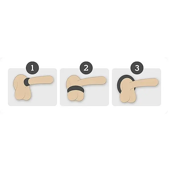 Imagem de infográfico com três passos para utilizar o anel peniano Dom